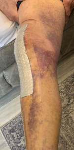 a2bmykr5uyvc.png a2bmykr5uyvc.png