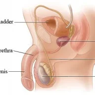 EnlargedProstateDawg