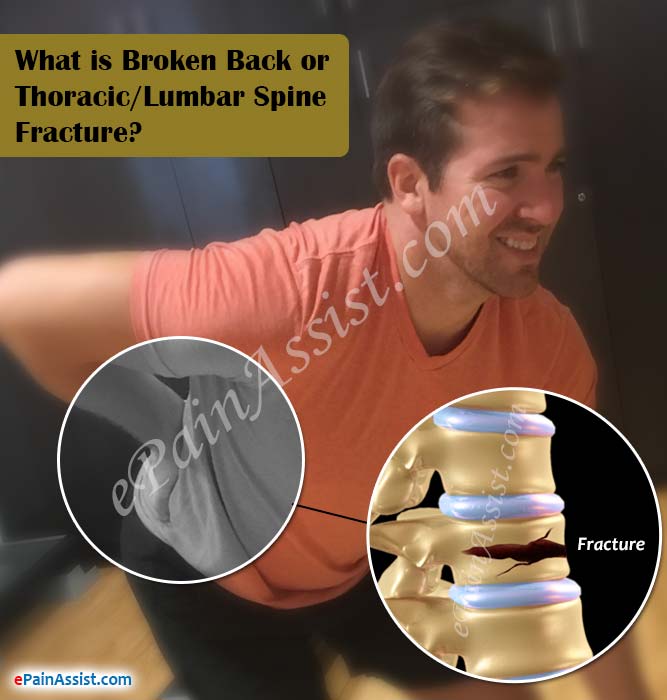 what-broken-back.jpg