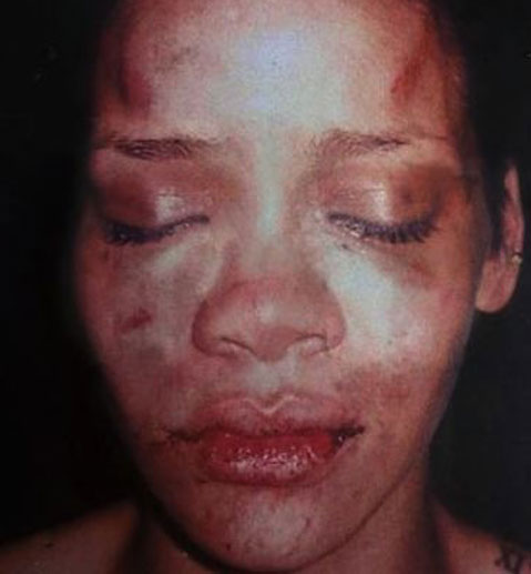 rihanna_beaten_face.jpg