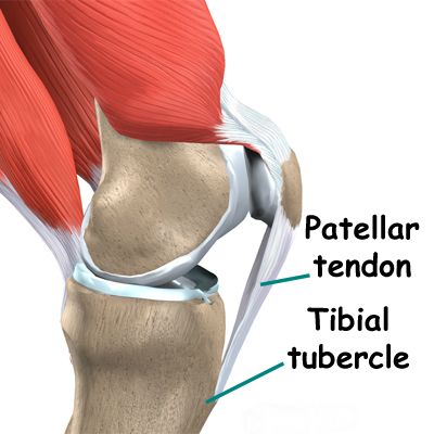 patellar_tendonitis.jpg